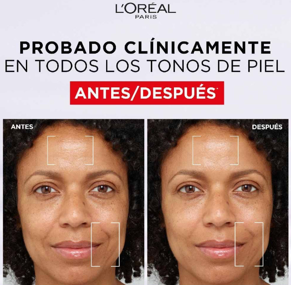 L’Oréal Paris Revitalift Filler Gel en Crema de Ácido Hialurónico 50ML